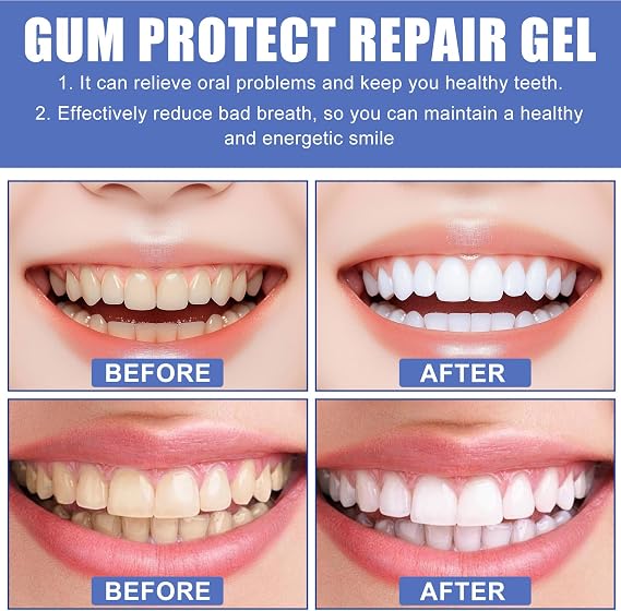 Chryaway® Gum Protect Repair Gel for Receding Gums & Sensitivity